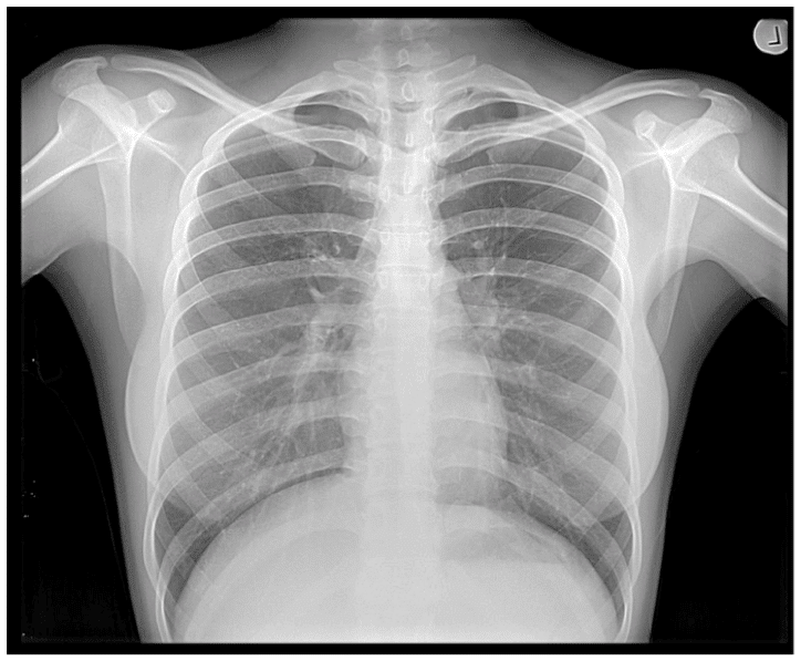 X Ray scan